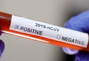 В Беларуси официально подтверждено 6 случаев COVID-19. Где в Лиде и регионе можно сдать анализ на коронавирус?