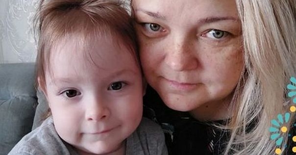 Продолжается сбор для двухлетней девочки Риты Юшкевич из Лиды с редким генетическим заболеванием