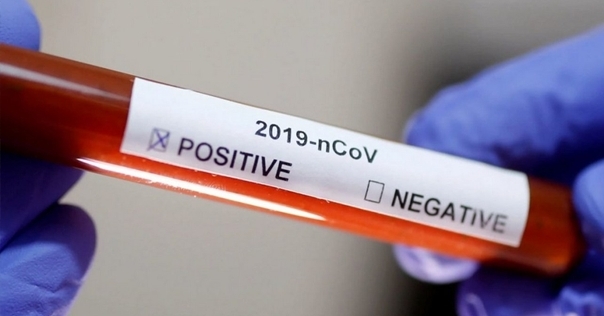 В Беларуси официально подтверждено 6 случаев COVID-19. Где в Лиде и регионе можно сдать анализ на коронавирус?